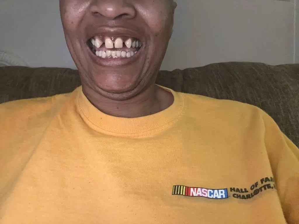 Aspen Dental