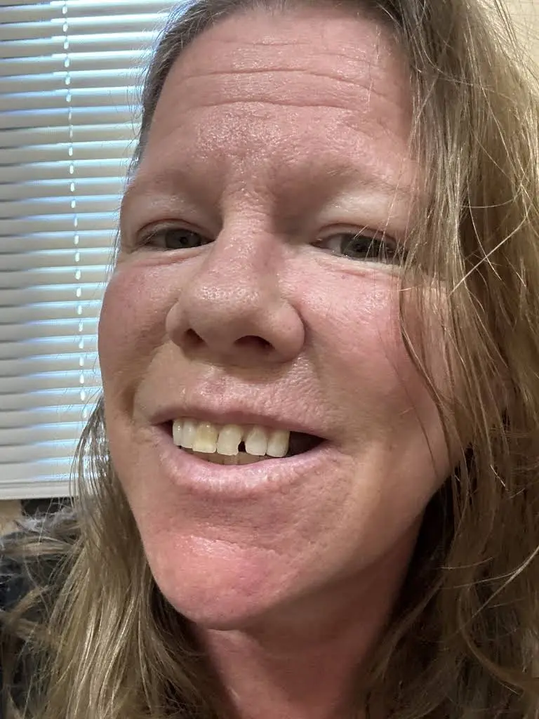 Aspen Dental