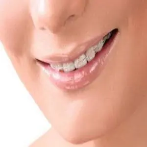 Chikes Orthodontics