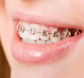 Chikes Orthodontics