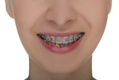 Chikes Orthodontics