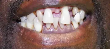 Jenkins Harry DDS
