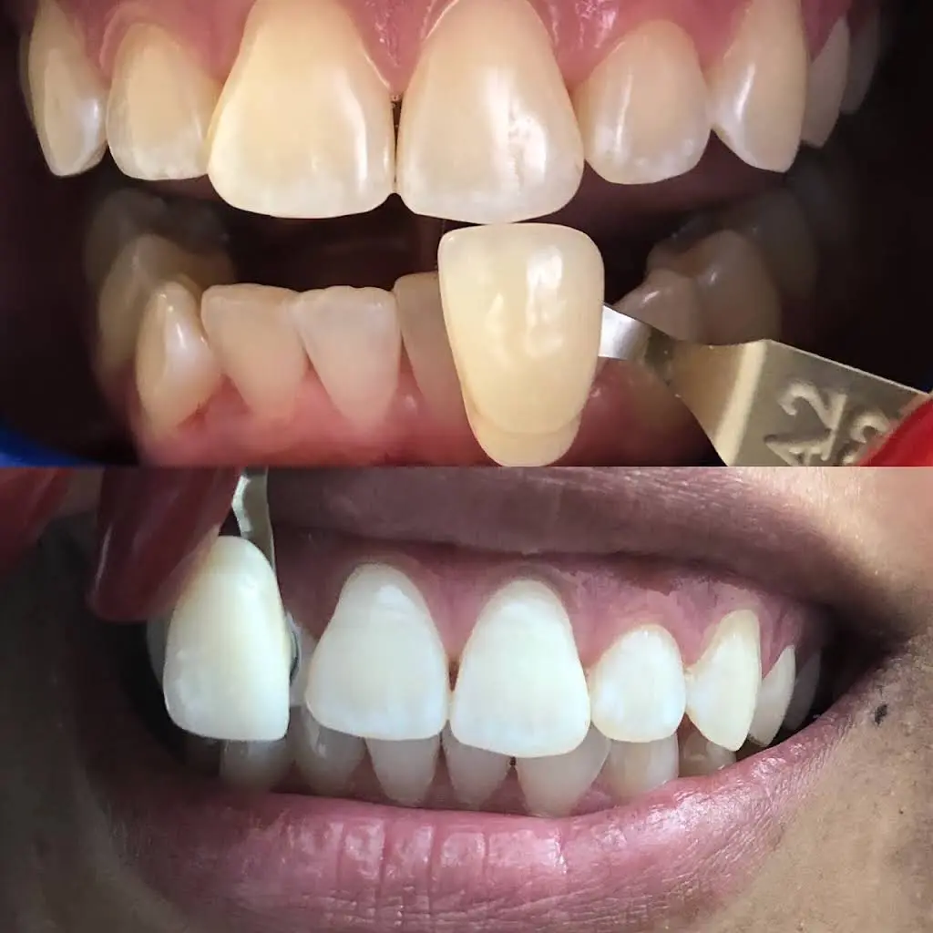 Spring Lake Dental Group