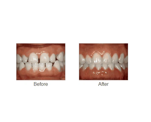 Reed & Sahlaney Orthodontics