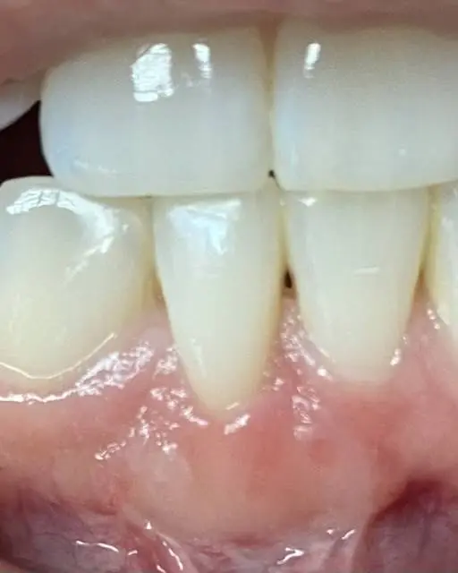 Keystone Periodontal Group