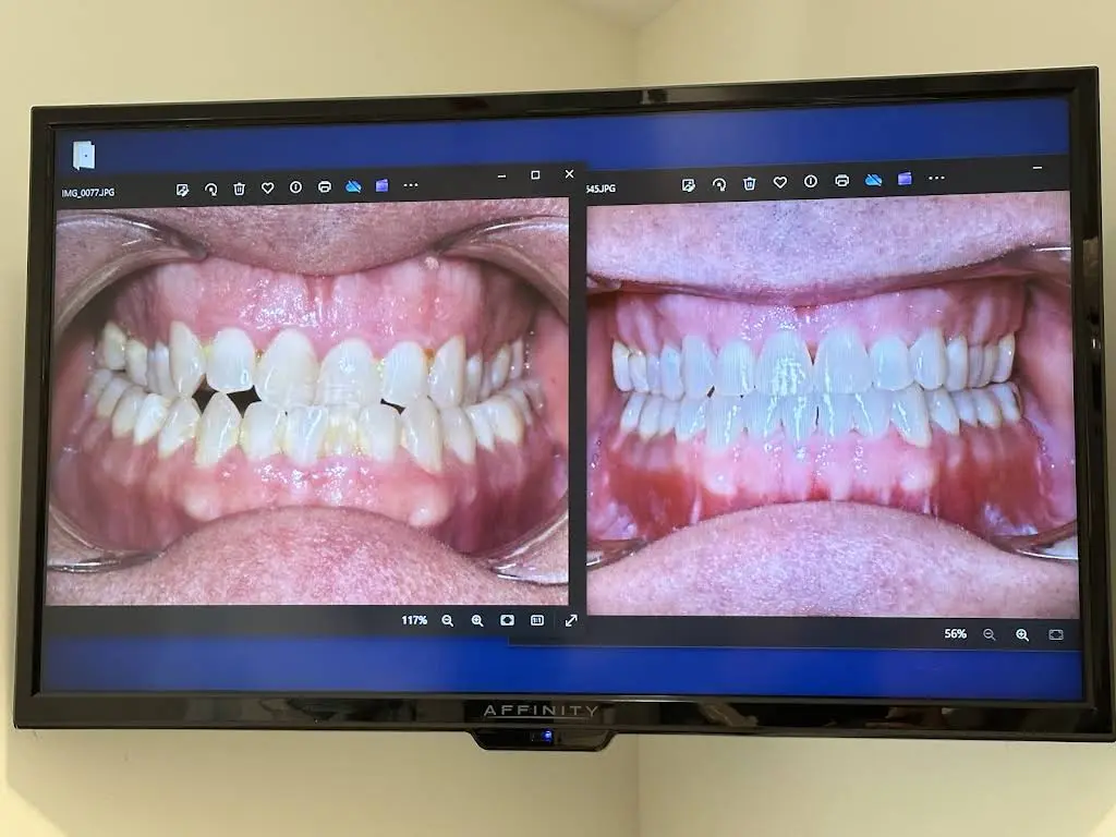 Ai Orthodontics