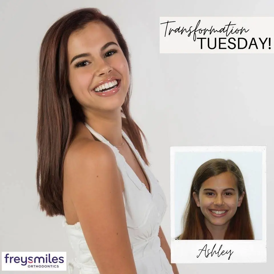 FreySmiles Orthodontics