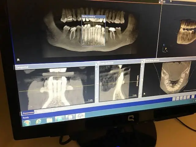 Olmsted Village Dental Care