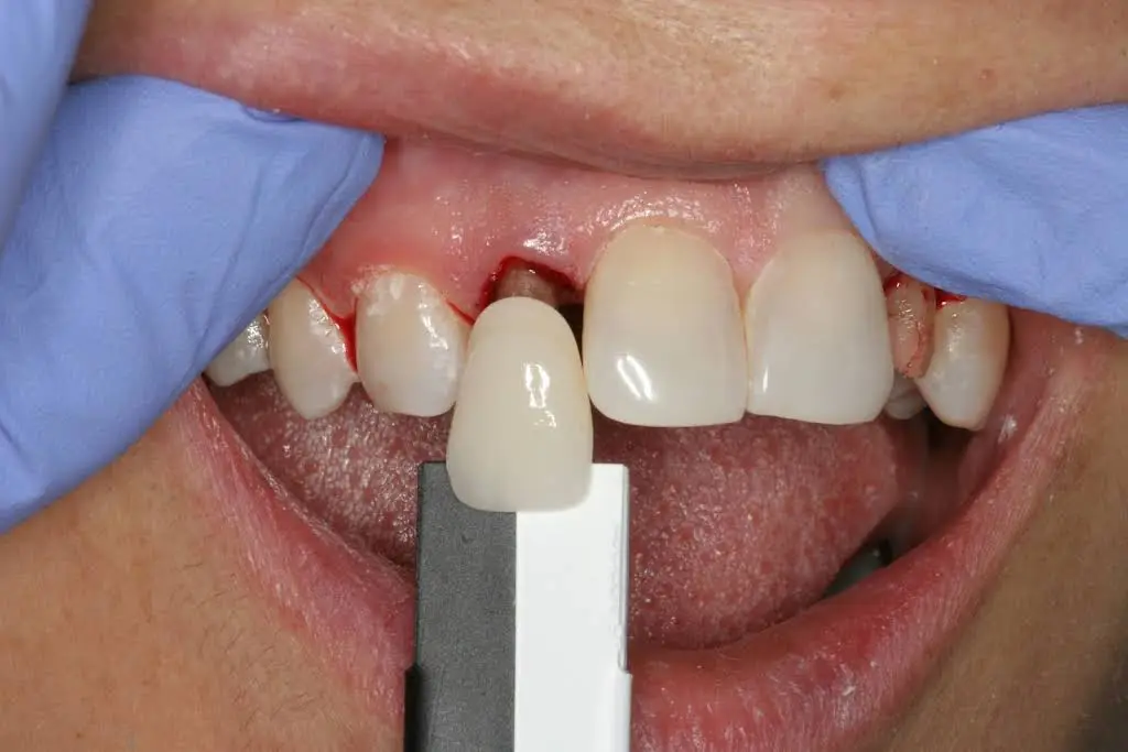 Dental Design Innovations