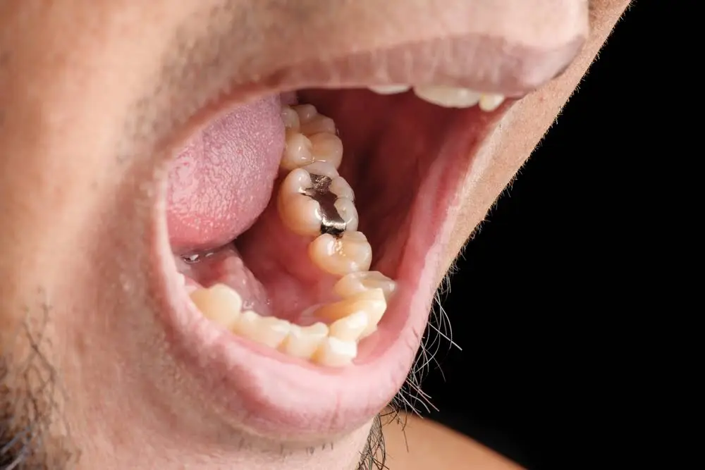 Hempfield Dental Care