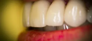 Downingtown Dental Studio
