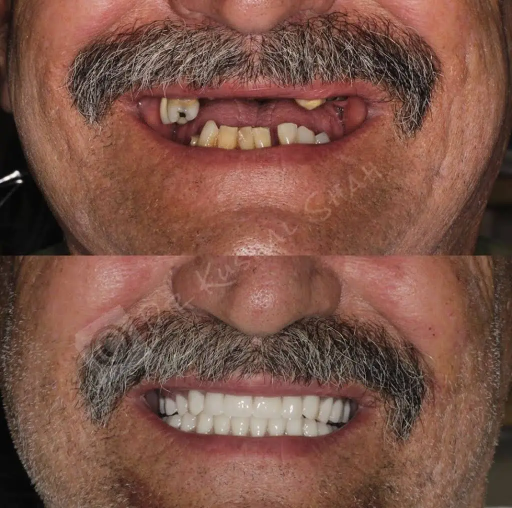 Downingtown Dental Studio