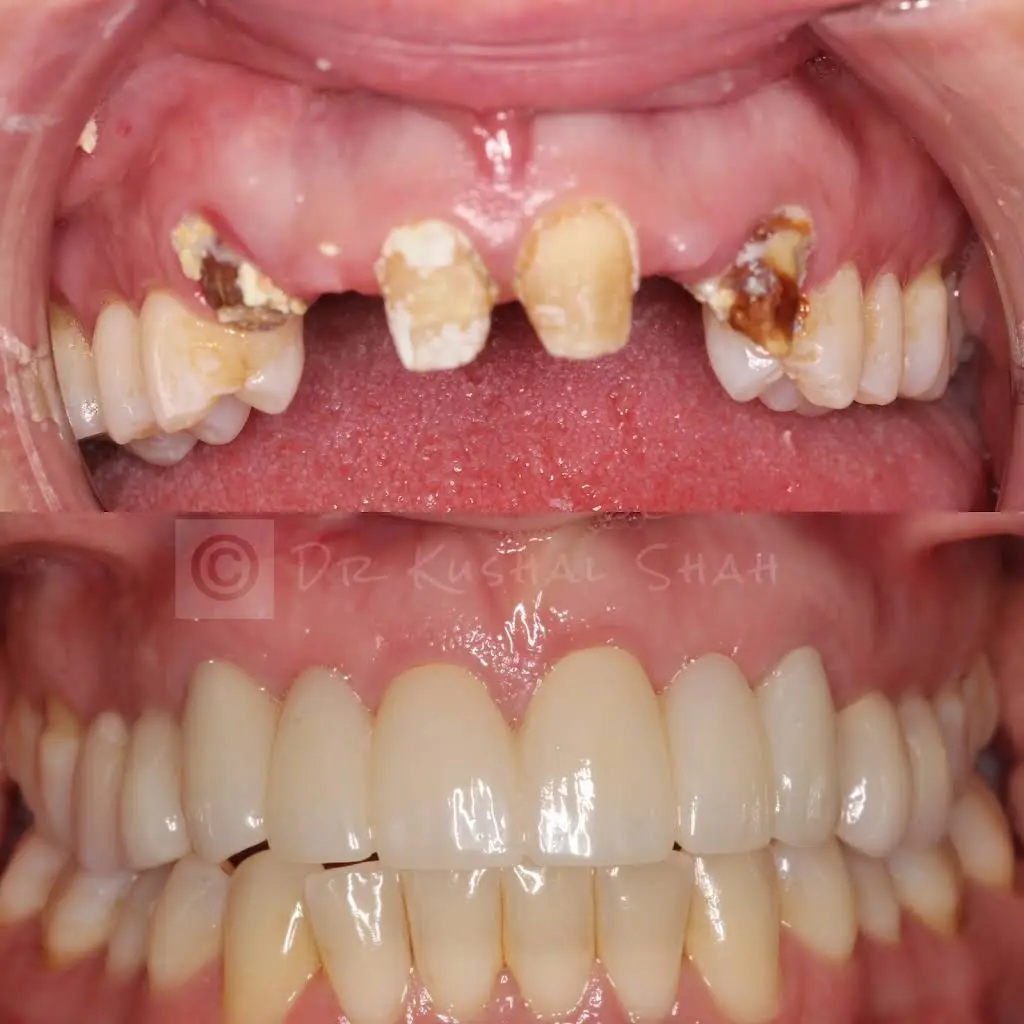 Downingtown Dental Studio