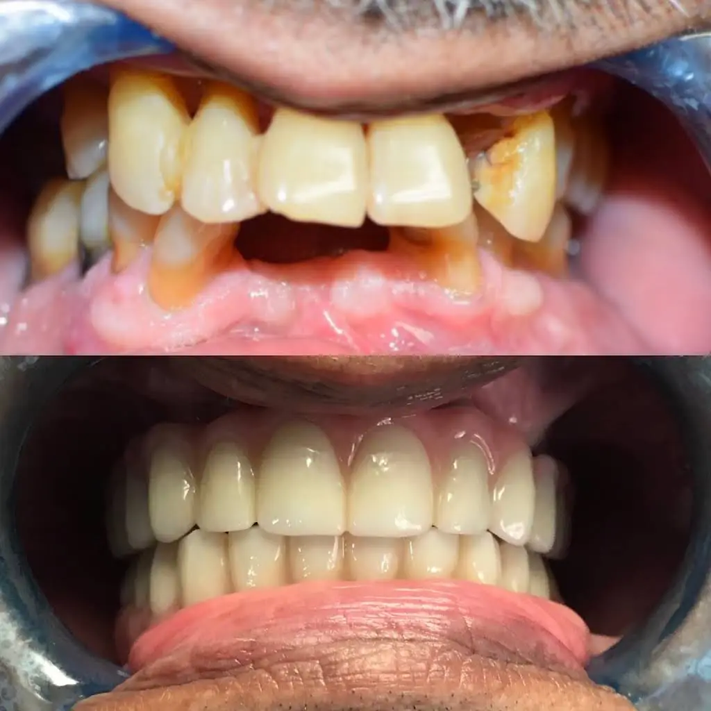 Eagle Family & Implant Dentistry