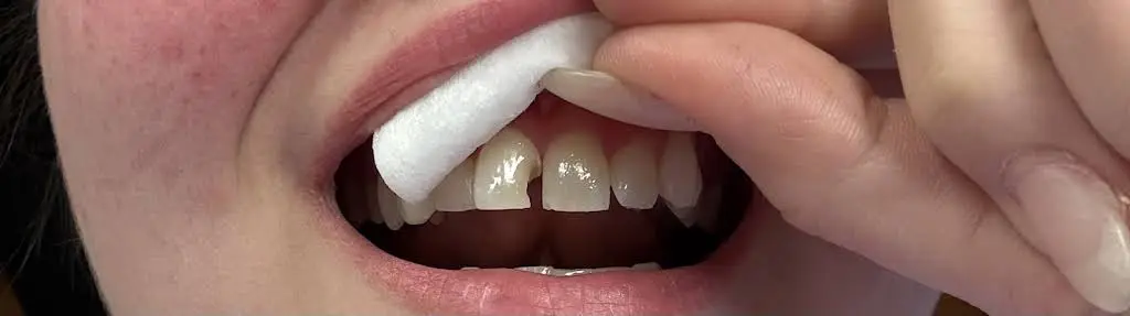 Pottstown Family Dental