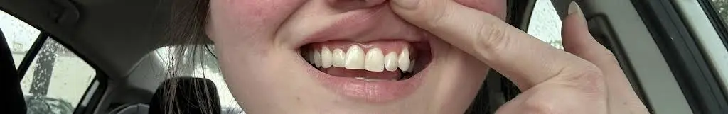 Pottstown Family Dental