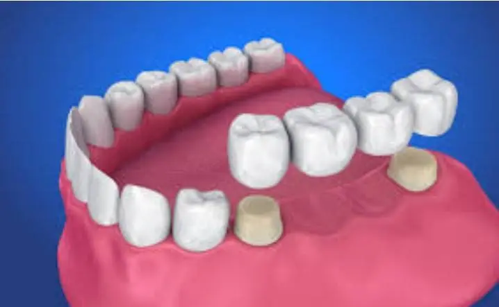 Whitehall Dental Group