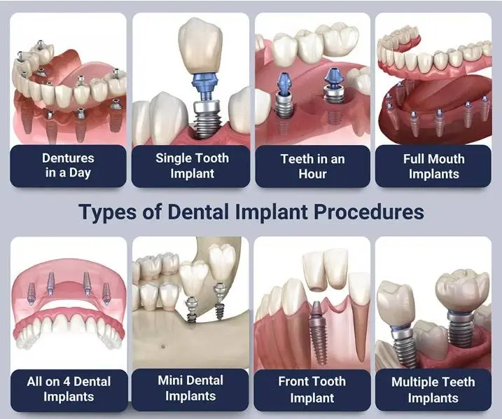 Whitehall Dental Group