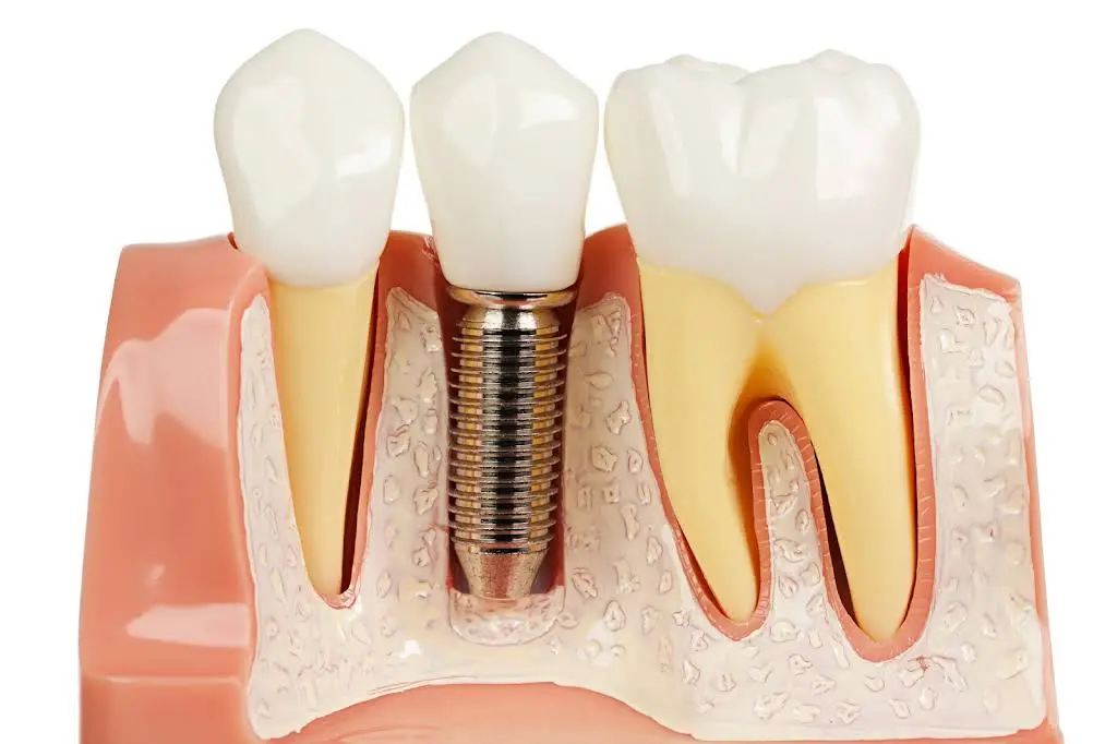 Whitehall Family Dentistry