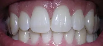 Lehigh Valley Sculpted Smiles: Michael E. Kun, DMD