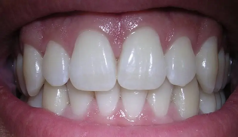 Lehigh Valley Sculpted Smiles: Michael E. Kun, DMD