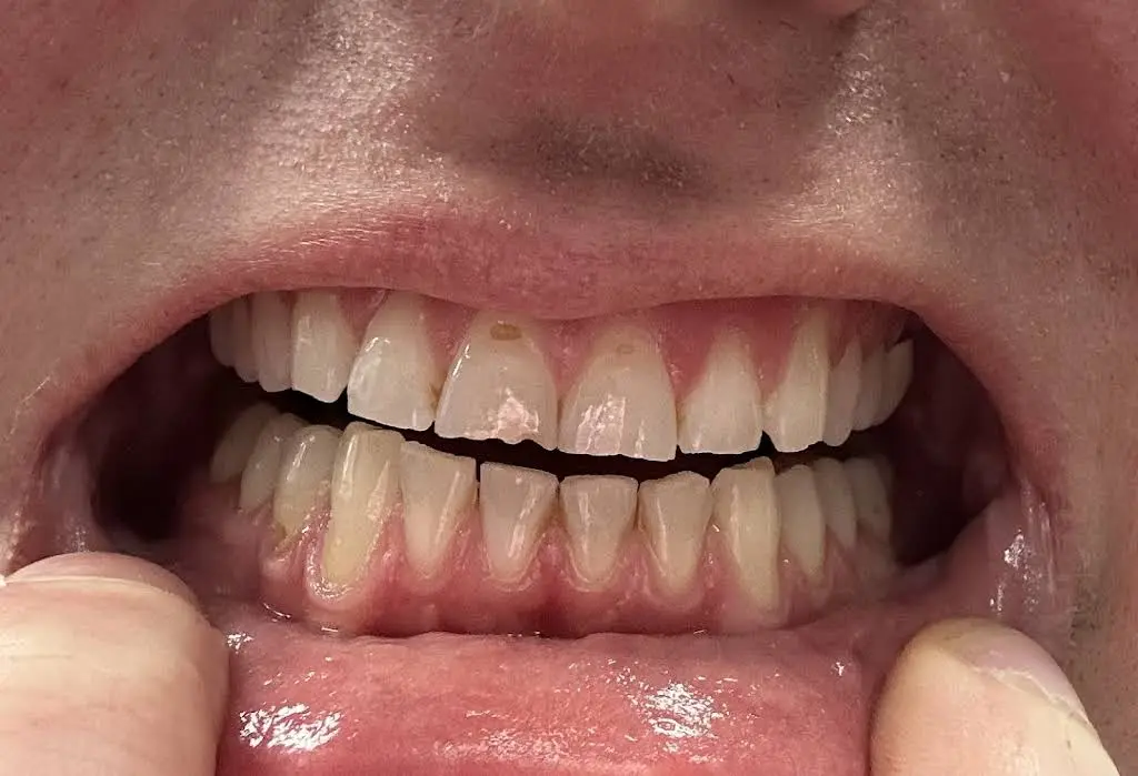 Aspen Dental