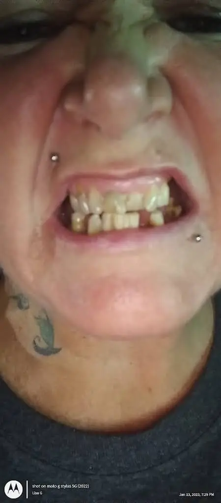 Affordable Dentures & Implants