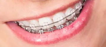 Henry Orthodontics
