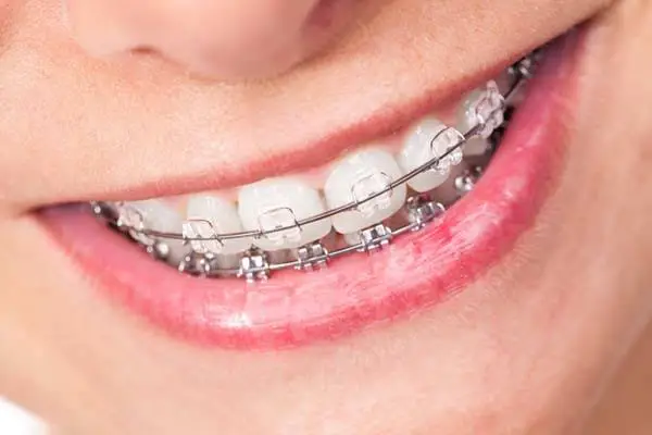Henry Orthodontics