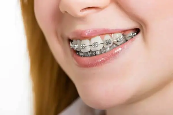 Henry Orthodontics