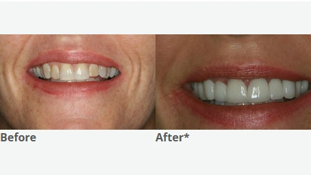 Advanced Dental Center of Florence