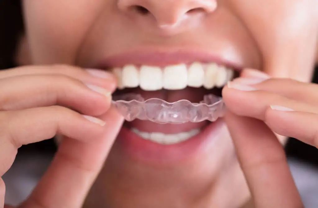 Brightside Orthodontics