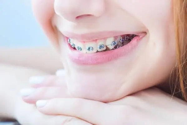 Henry Orthodontics