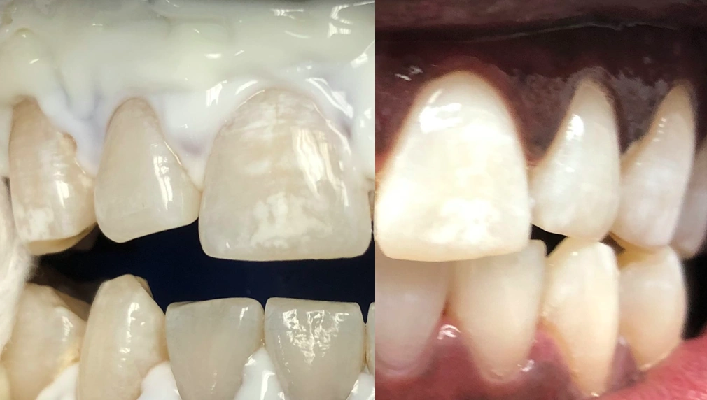 Main Line Smile Center