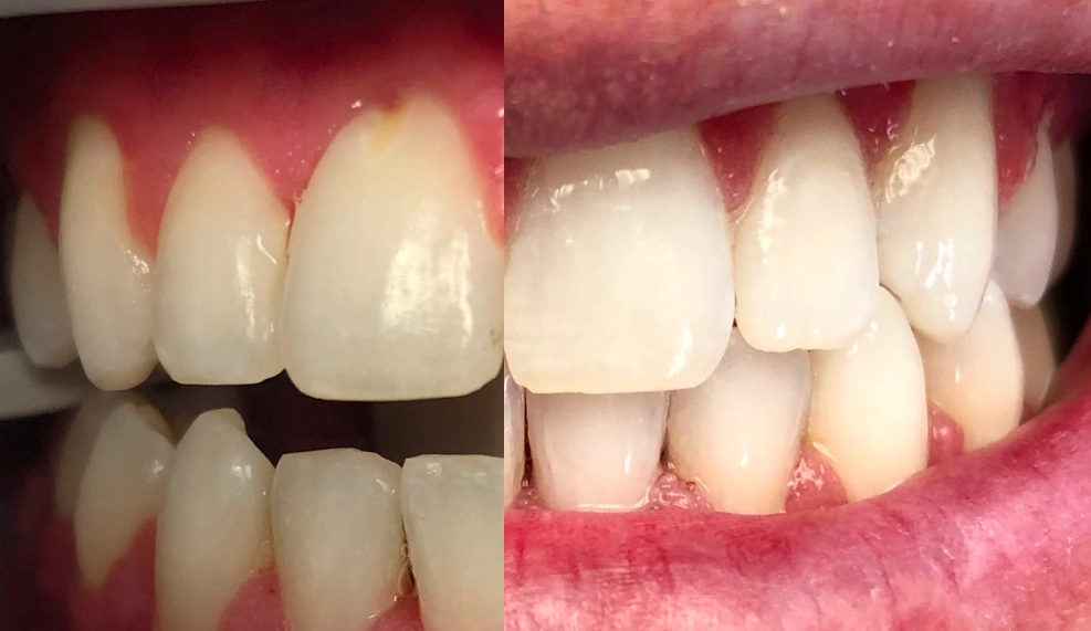 Main Line Smile Center