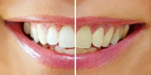 Main Line Smile Center