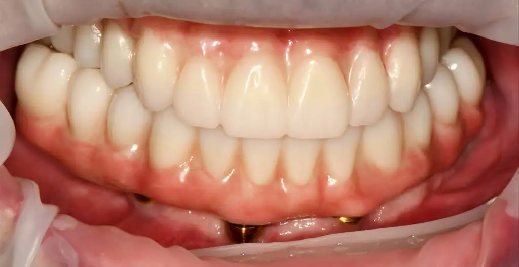 Bright Dental Practice & Implant Center