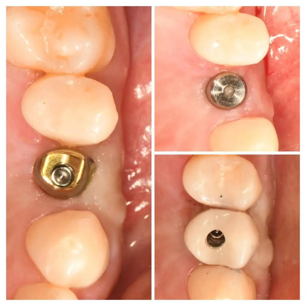 Bright Dental Practice & Implant Center