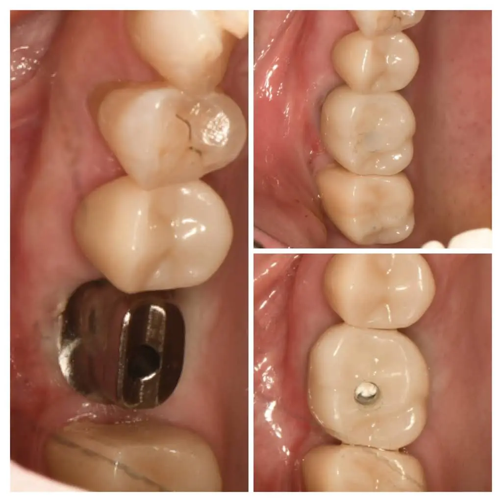 Bright Dental Practice & Implant Center