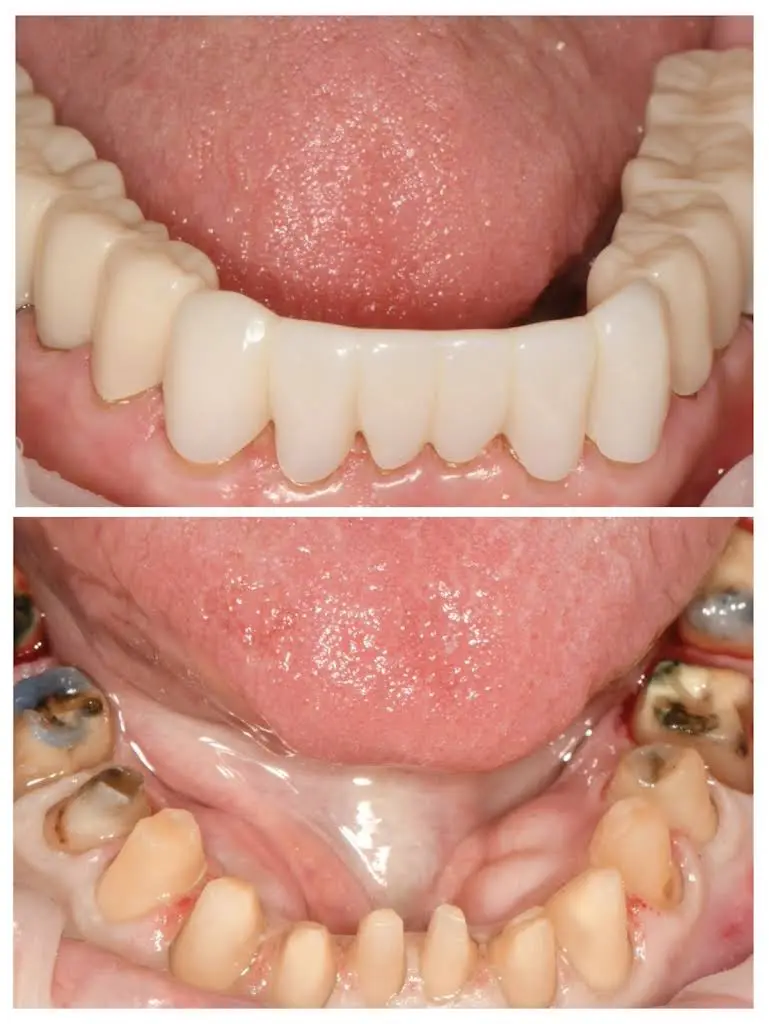 Bright Dental Practice & Implant Center