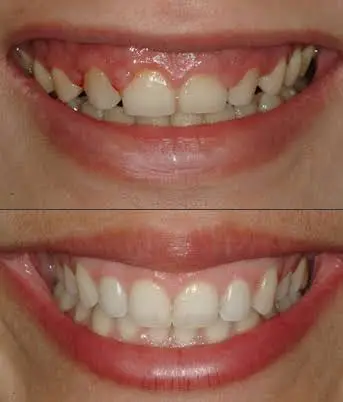 Always About Smiles: Thomas R. Lambert DMD