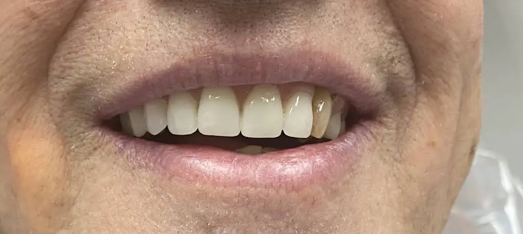 Lehigh Valley Cosmetic Dentistry