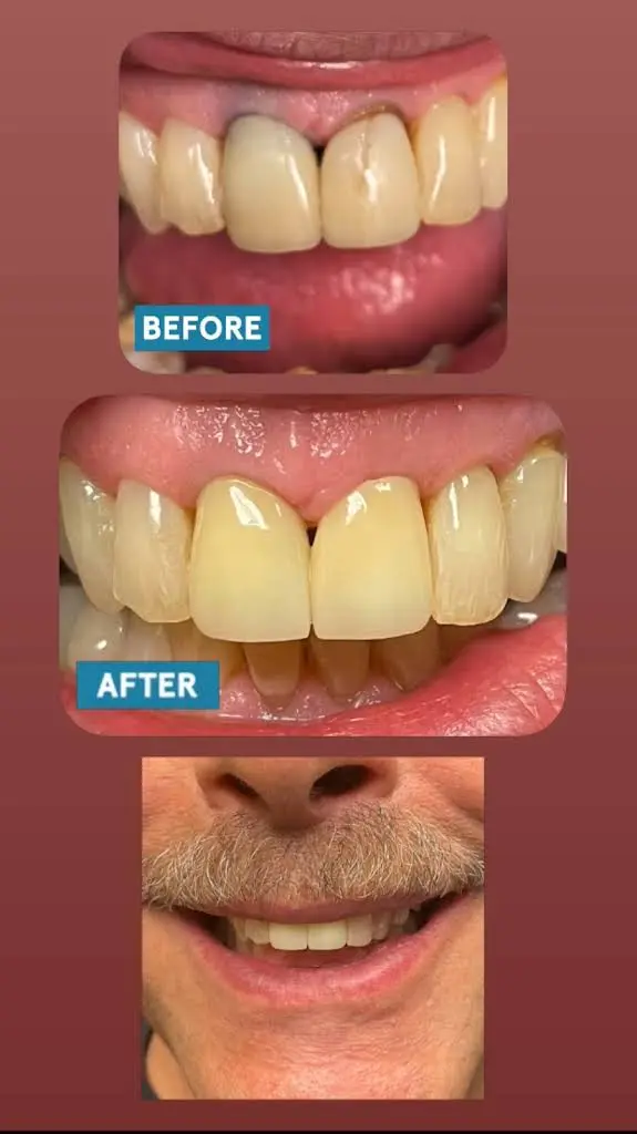 Blue Valley Dental