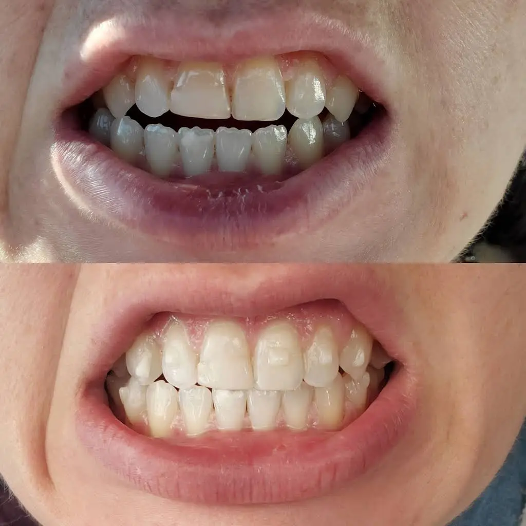Ridge Pike Dental Care