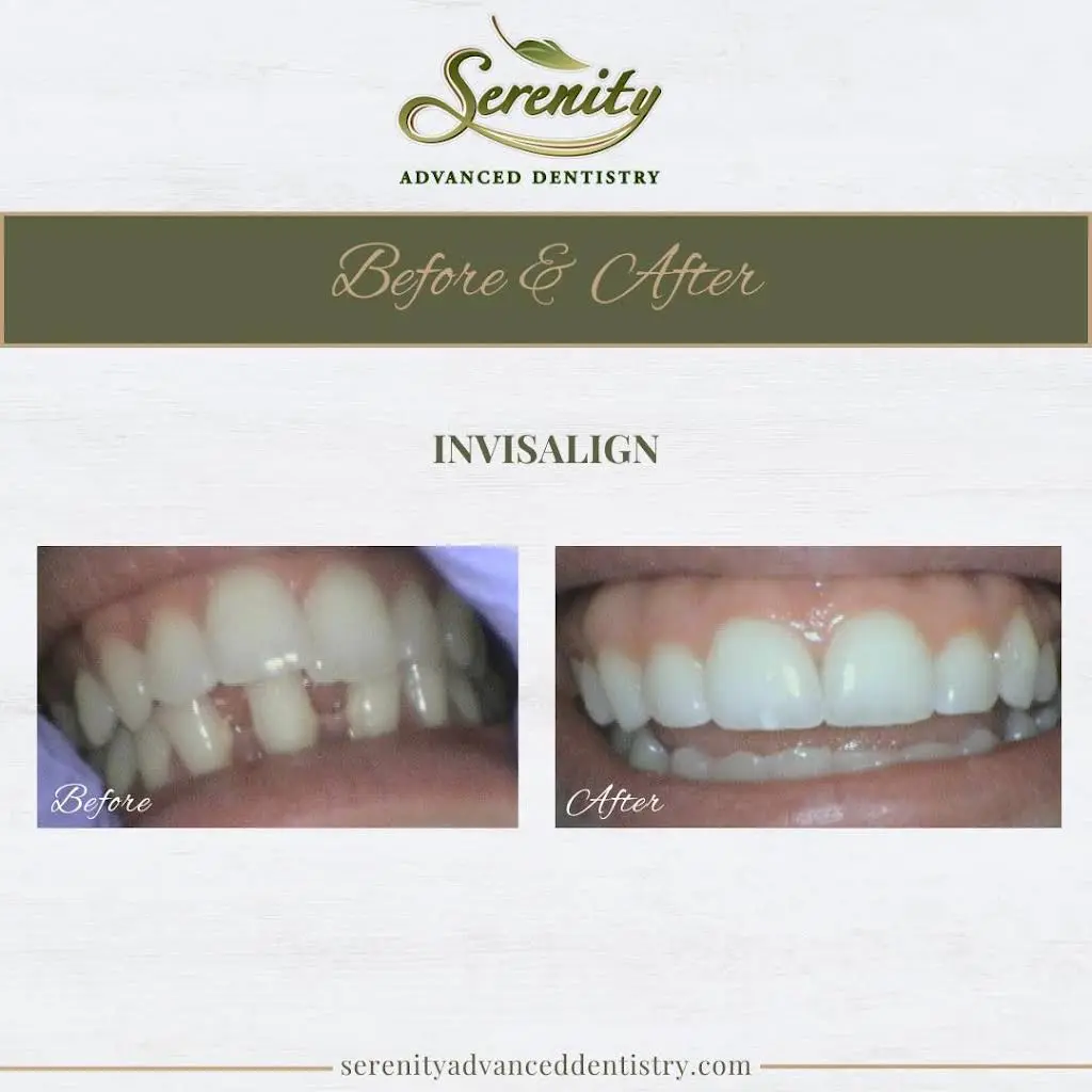 Serenity Advanced Dentistry