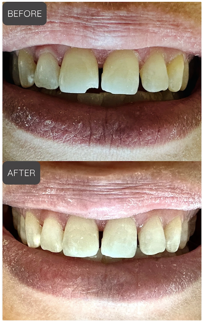 Palmer Smile Design