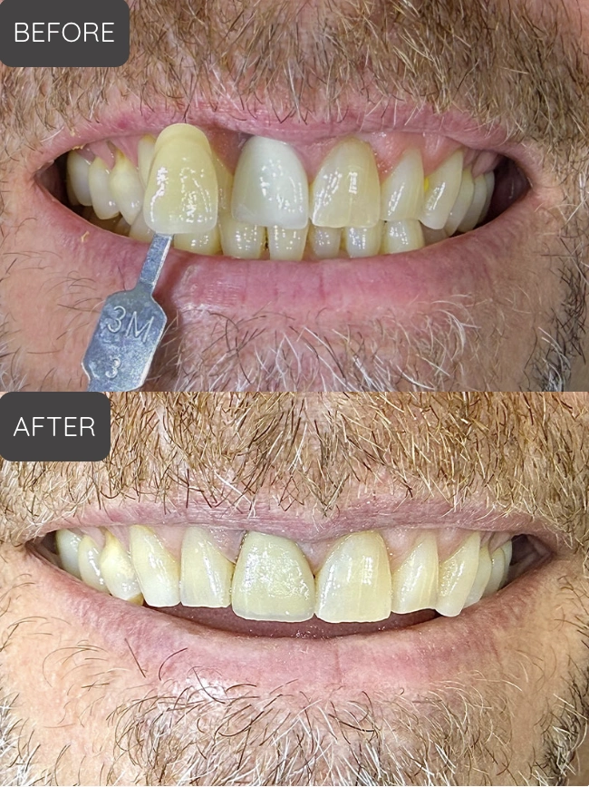 Palmer Smile Design