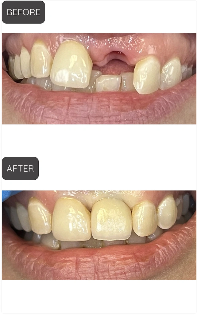 Palmer Smile Design