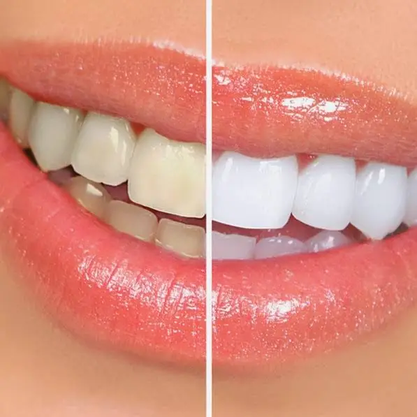 Pure Family Dentistry