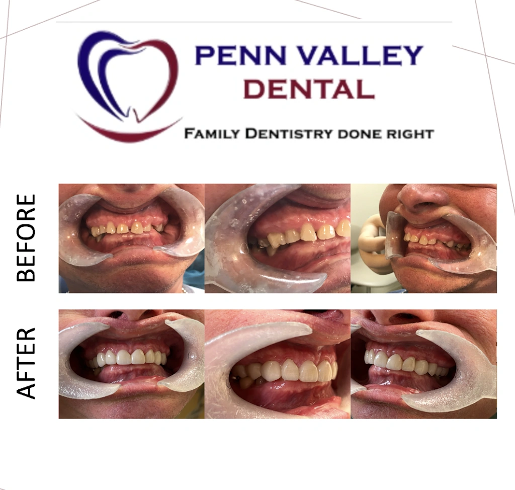 Penn Valley Dental